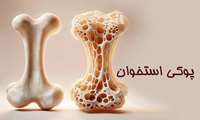 ویدئو آموزشی پوکی استخوان
